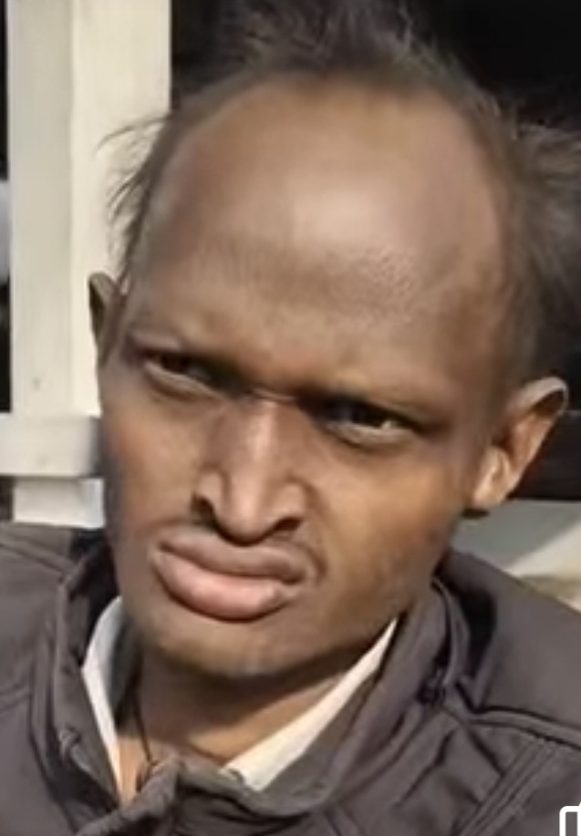 दिव्यांग से मारपीट मामले में पुलिस ने नहीं दर्ज की प्राथमिकी