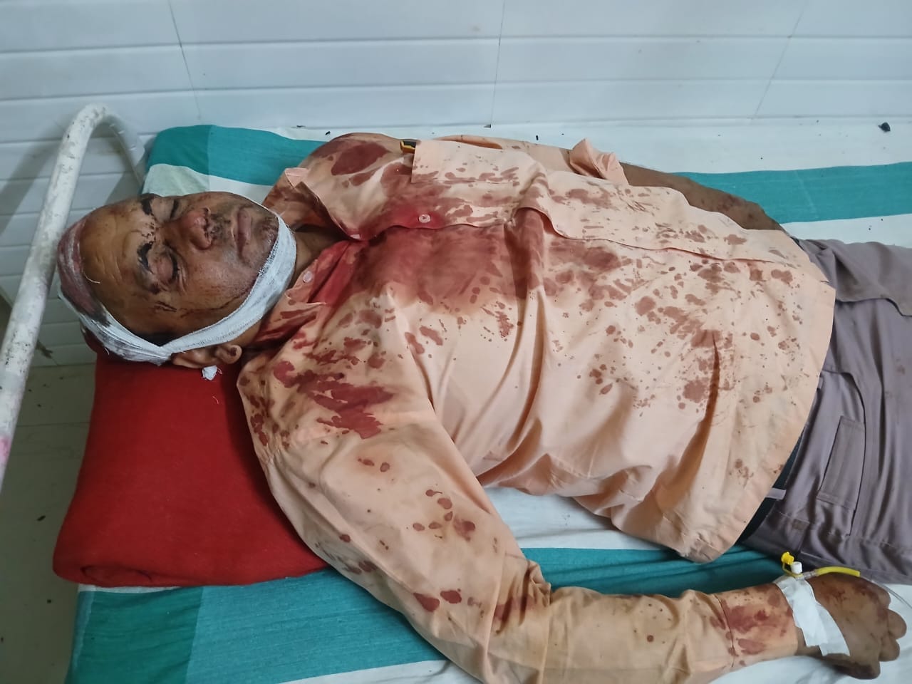 आजमगढ़ में भूमि विवाद में पिता-पुत्र पर जानलेवा हमला,हालत नाजुक